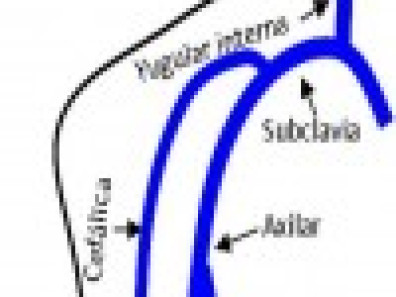 DOPPLER VENOSO URGENTE DE LAS EXTREMIDADES SUPERIORES