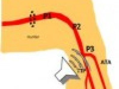  ECOGRAFíA DOPPLER ARTERIAL DE EXTREMIDADES INFERIORES