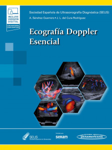 Doppler esencial